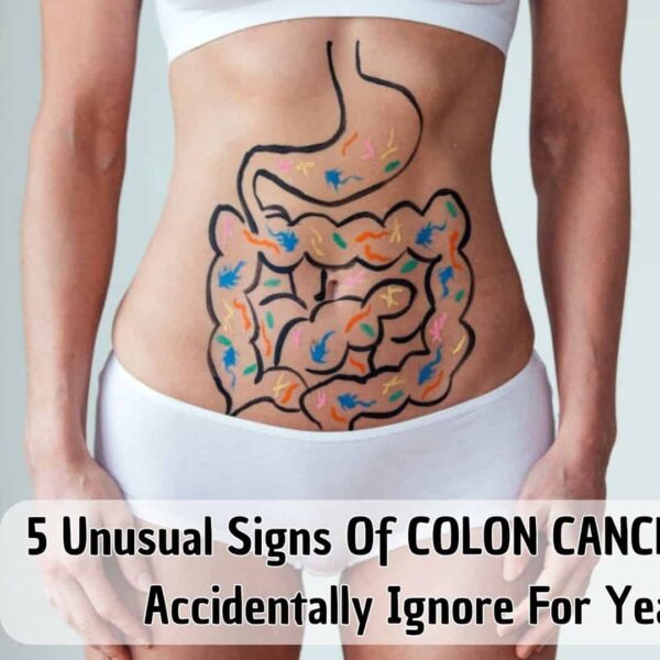 5 Unusual Signs Of COLON CANCER People Accidentally Ignore For Years.