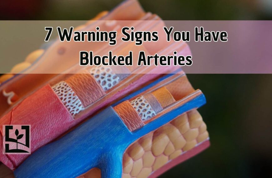 Here Are 7 Warning Signs You Have Blocked Arteries