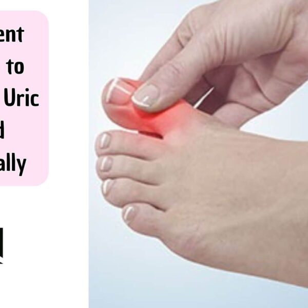 9 Potent Ways to Reduce Uric Acid Naturally