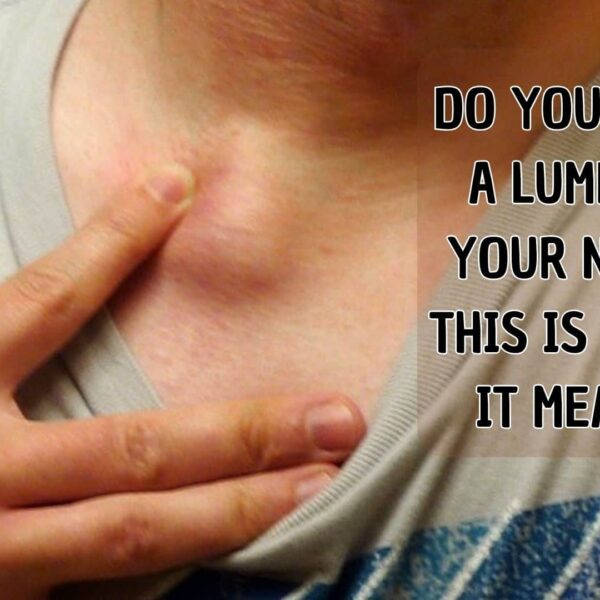 DO YOU HAVE A LUMP ON YOUR NECK, BACK, OR BEHIND YOUR EAR? THIS IS WHAT IT MEANS!