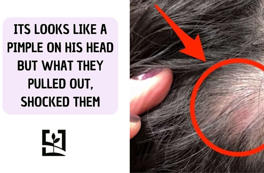 ITS LOOKS LIKE A PIMPLE ON HIS HEAD BUT WHAT THEY PULLED OUT, SHOCKED THEM