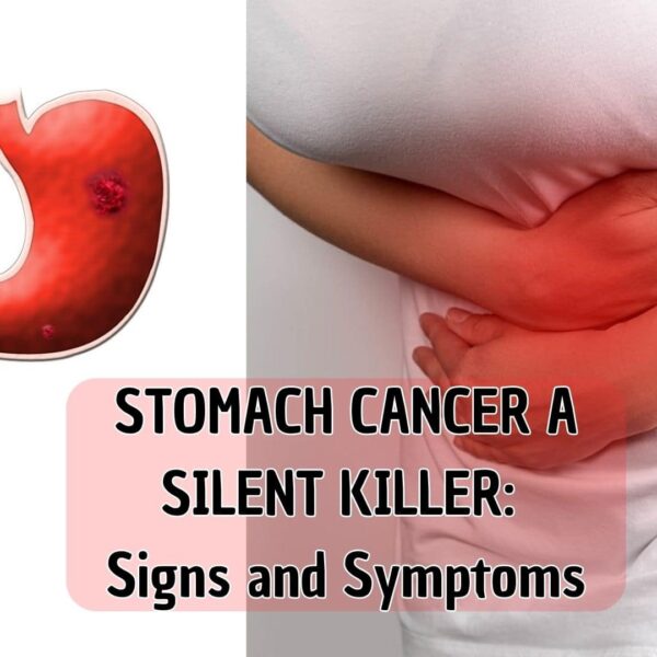 STOMACH CANCER A SILENT KILLER: Here Are The Signs & Symptoms