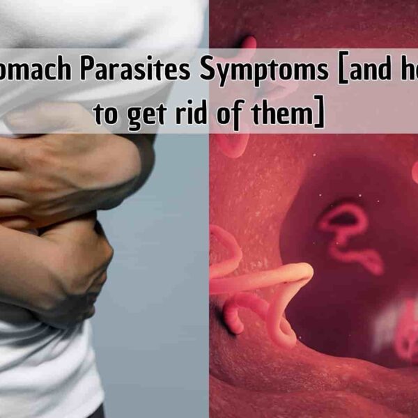 Stomach Parasites Symptoms [and how to get rid of them]