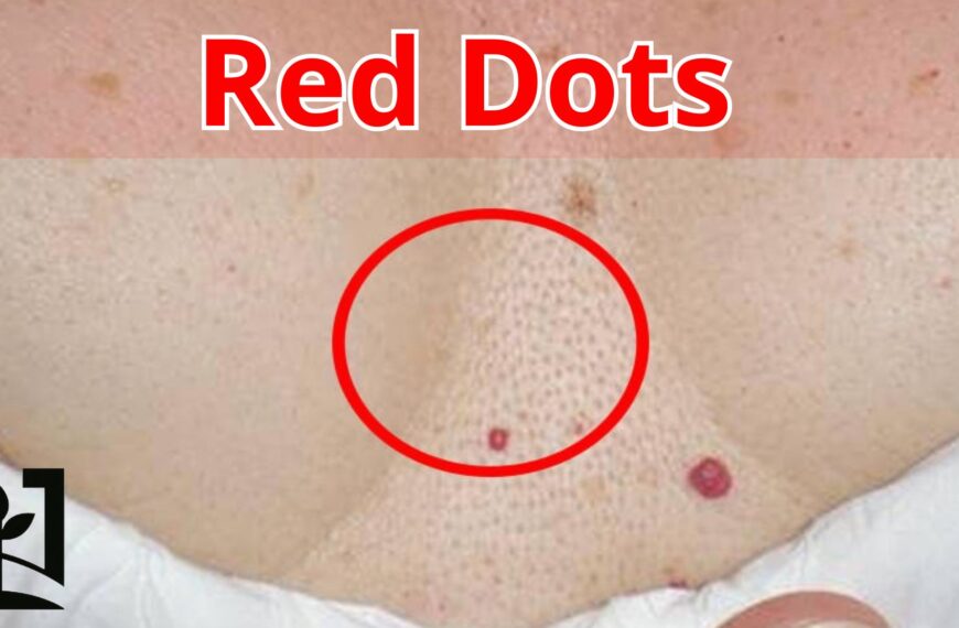 Red Dots on Your Skin: Causes and When to Seek Help